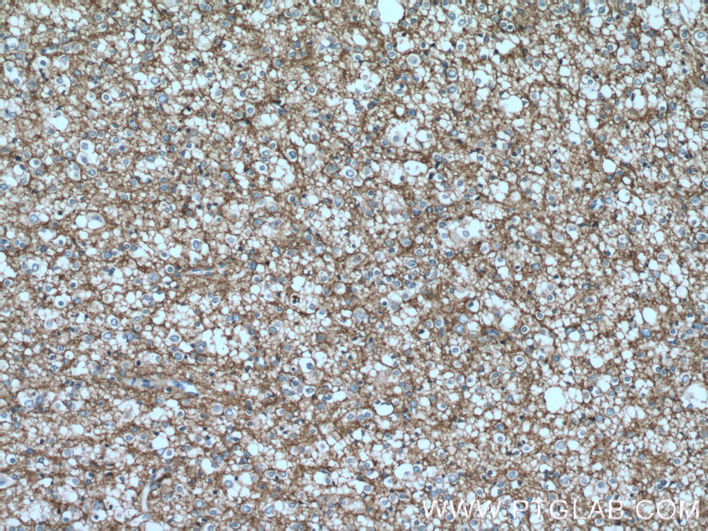 GNAO1 Polyclonal antibody