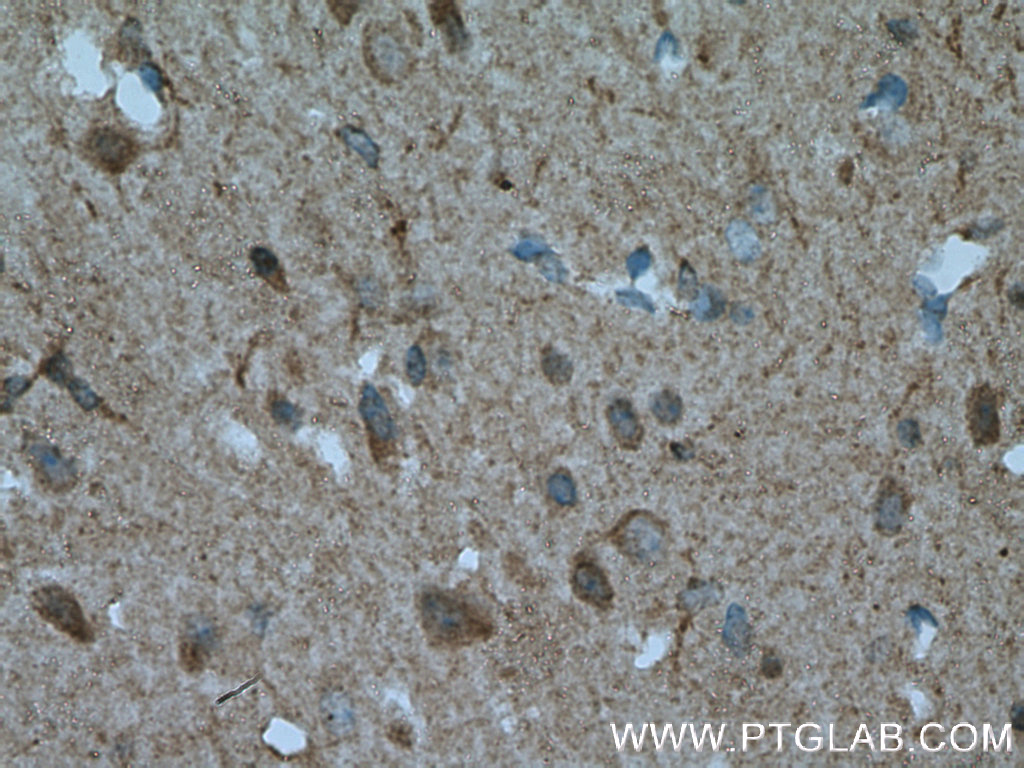 ENPP6 Polyclonal antibody