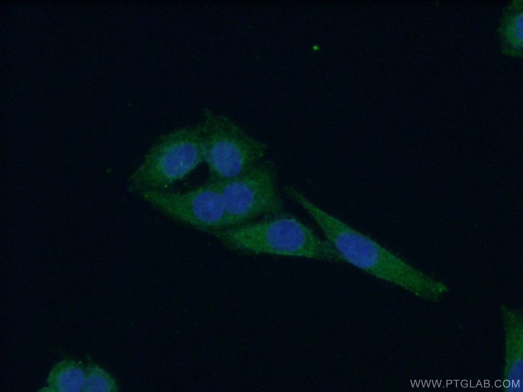 WDR16 Polyclonal antibody