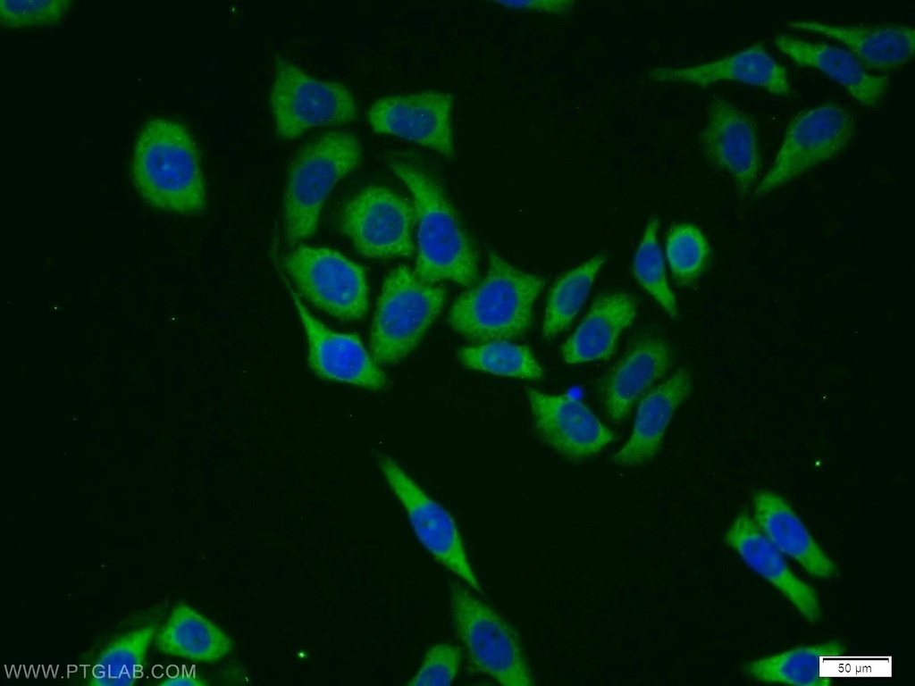 GlnRS Polyclonal antibody