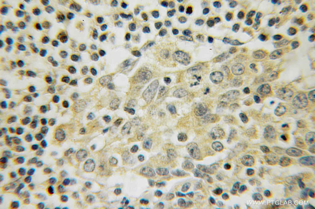 LANCL1 Polyclonal antibody