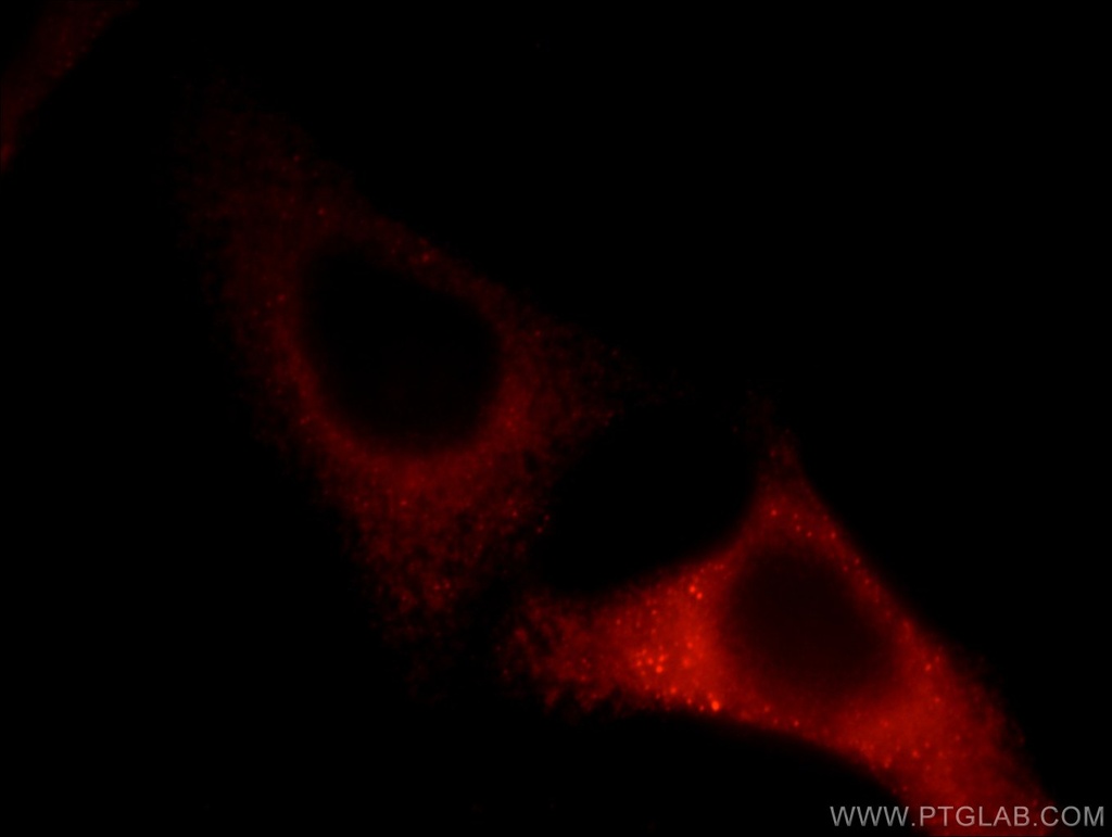 TCIRG1 Polyclonal antibody