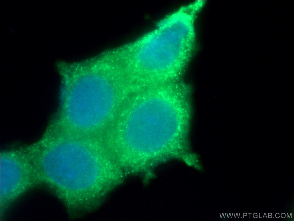 SIAH2 Polyclonal antibody
