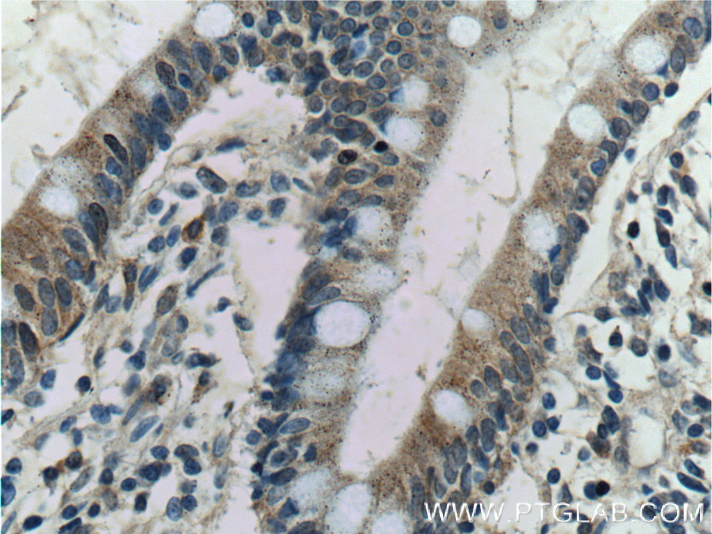 Kir7.1 Polyclonal antibody