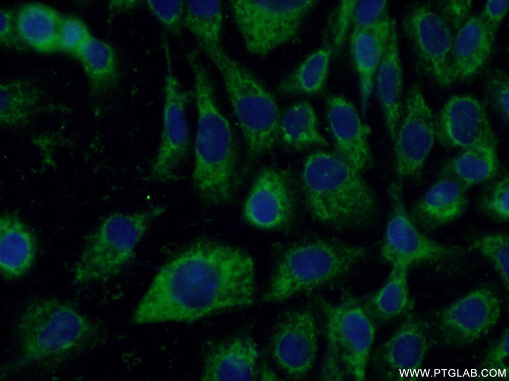 P4HA1 Polyclonal antibody