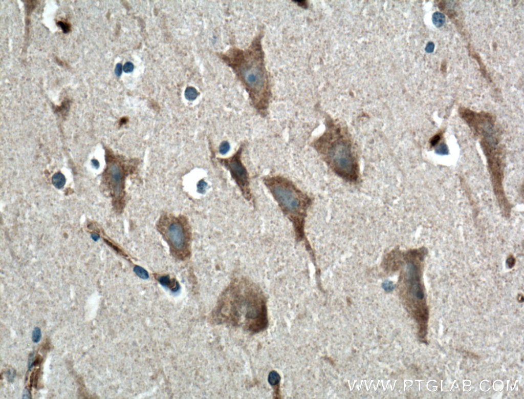 GPR155 Polyclonal antibody