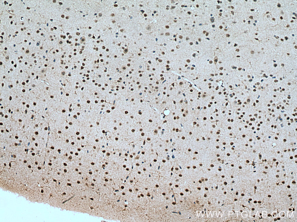 DBP Polyclonal antibody