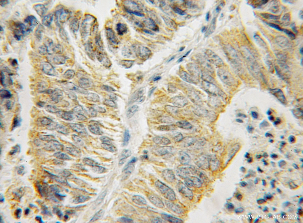 HSPA13 Polyclonal antibody
