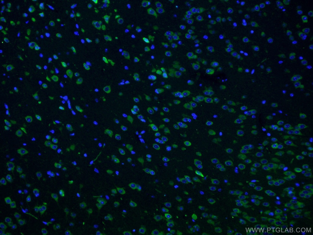 CPEB3 Polyclonal antibody