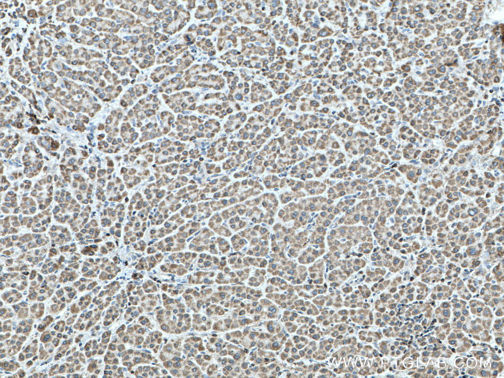 SHCBP1 Polyclonal antibody