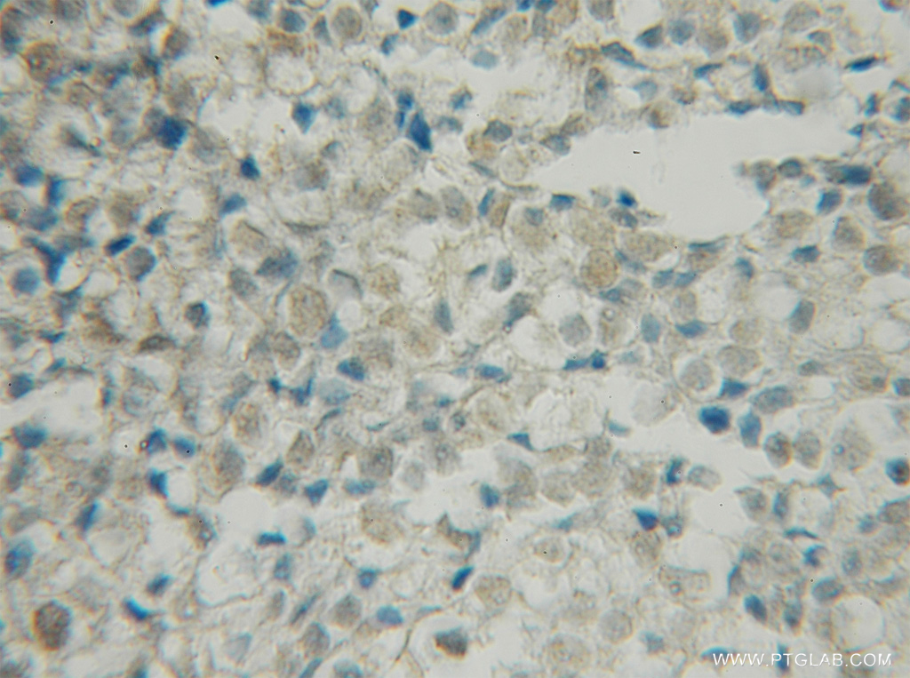 BRSK1 Polyclonal antibody