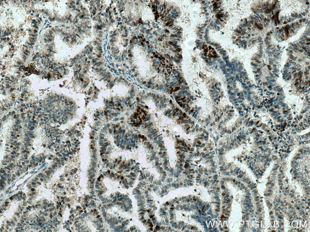 MAD2L2 Polyclonal antibody