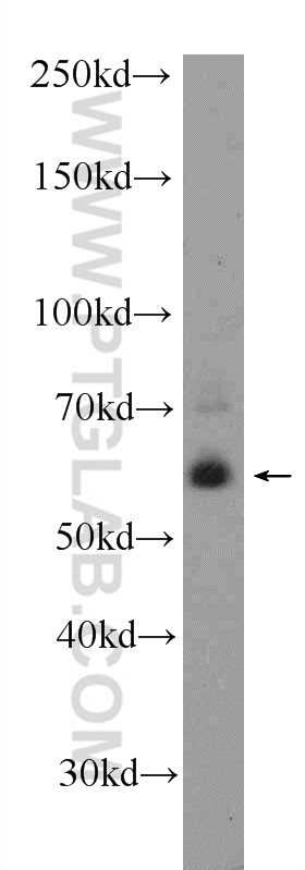 KCNV1 Polyclonal antibody