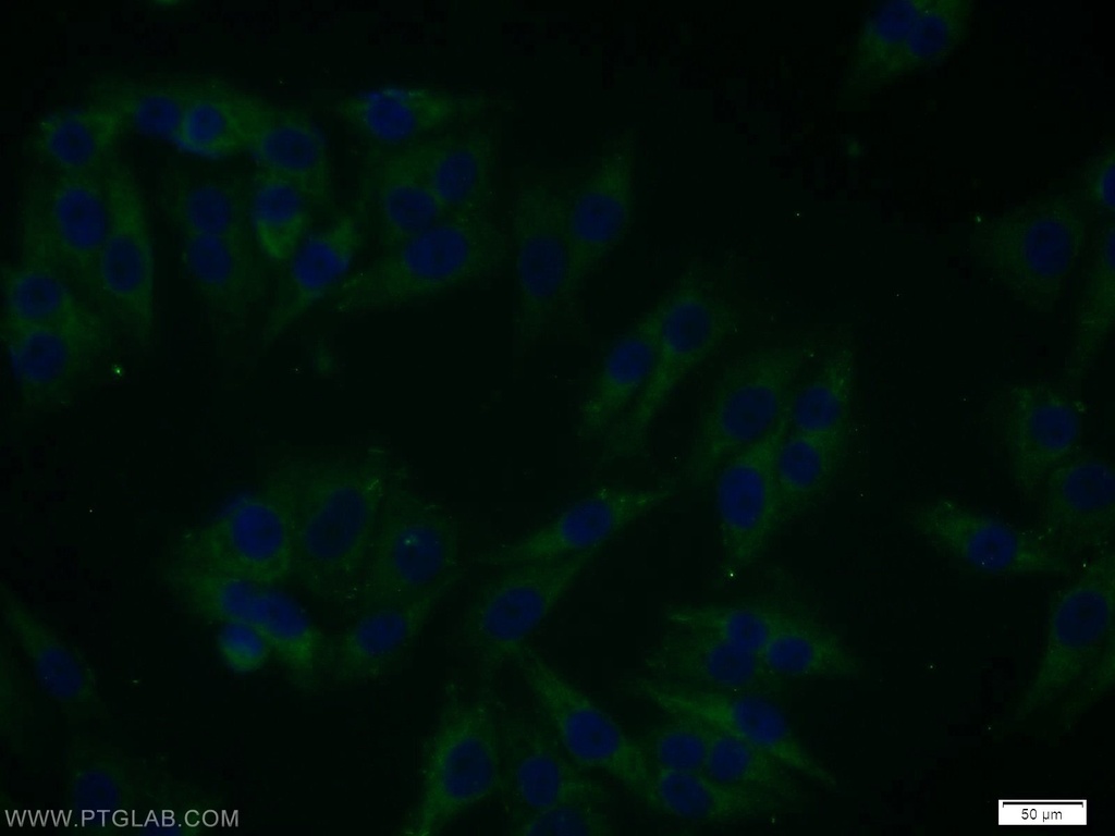 SGK3 Polyclonal antibody