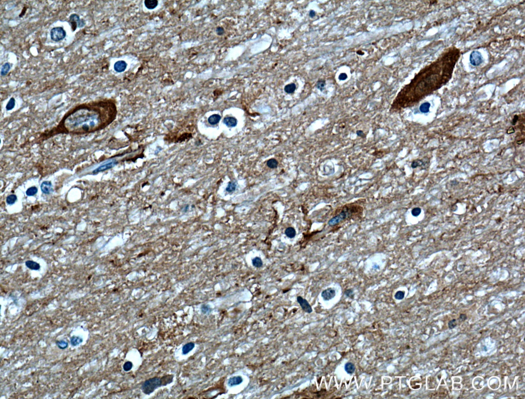 OMG Polyclonal antibody