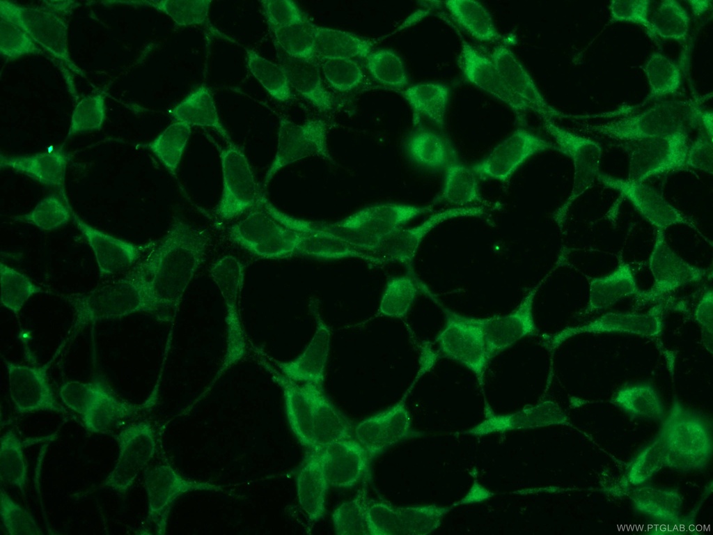 SNAP29 Polyclonal antibody