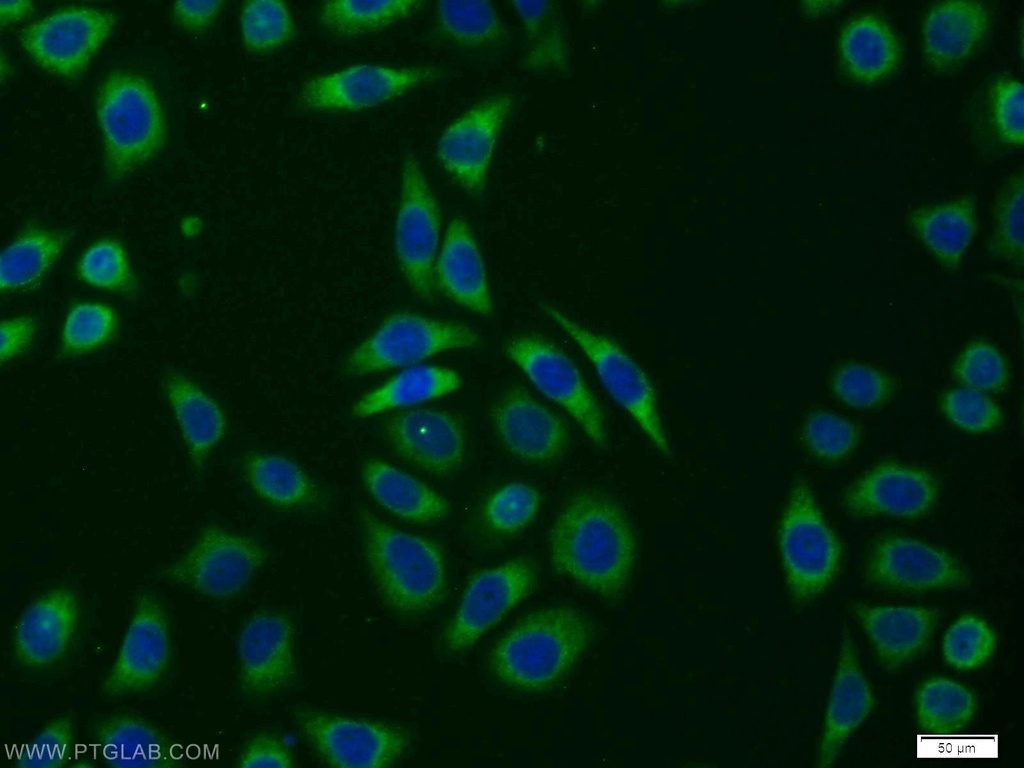 TRAM1 Polyclonal antibody