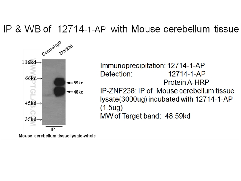 ZNF238 Polyclonal antibody