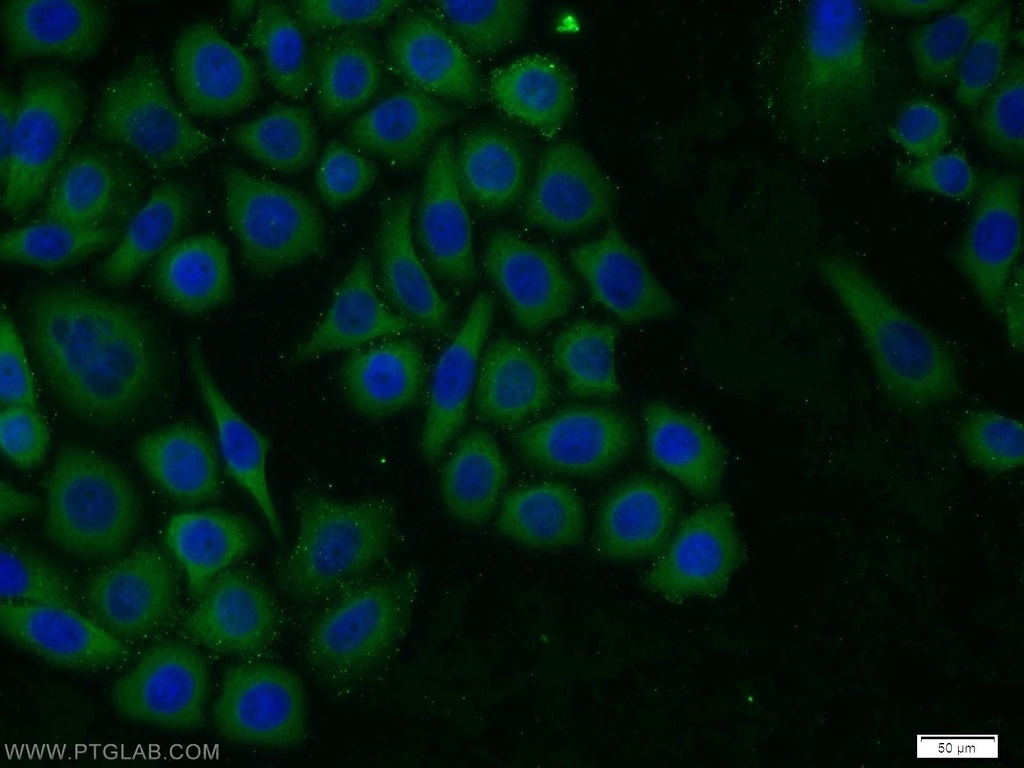 TROVE2 Polyclonal antibody