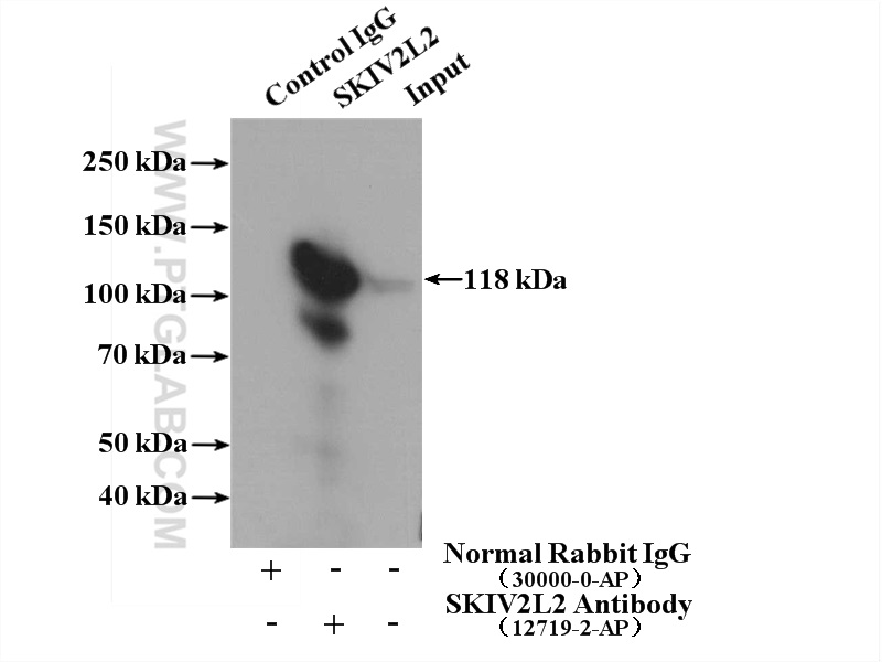 SKIV2L2 Polyclonal antibody