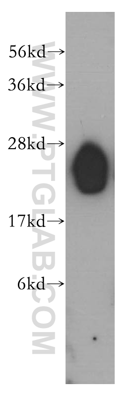 LIN7B Polyclonal antibody