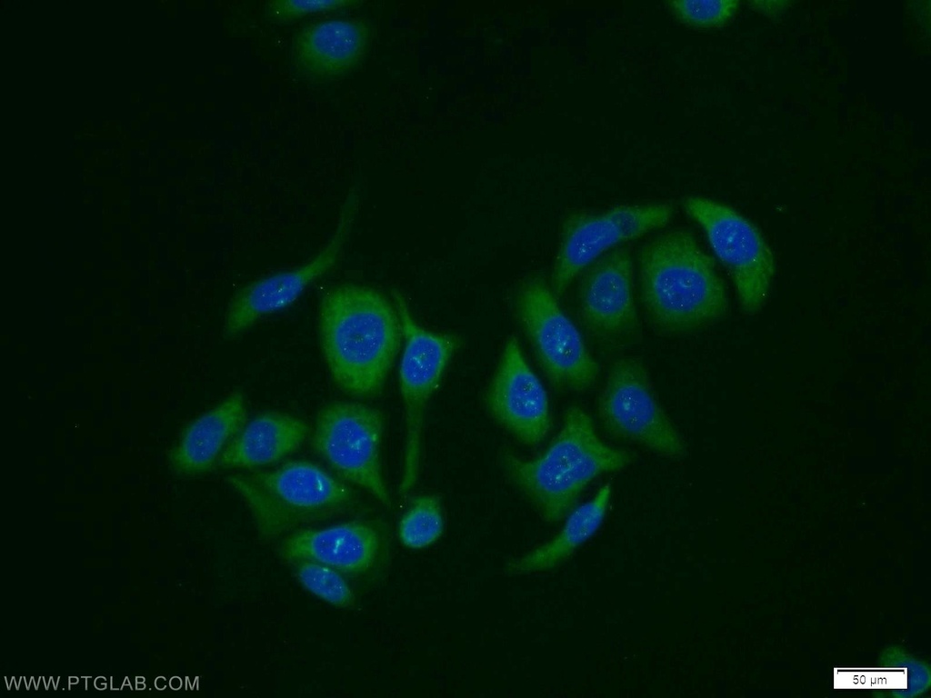 RabGEF1 Polyclonal antibody