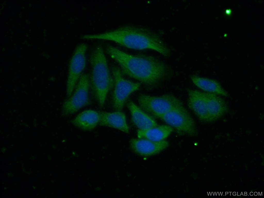 ADAMTS1 Polyclonal antibody