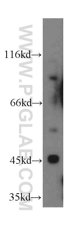 TRIM39 Polyclonal antibody
