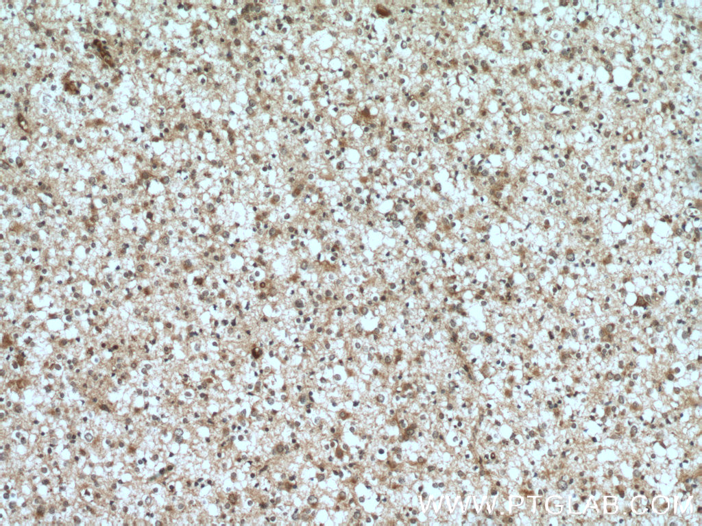 ELMOD1 Polyclonal antibody