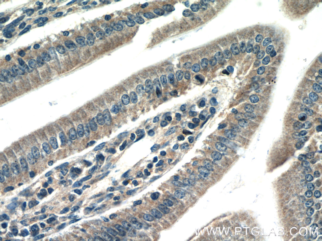 CBLB Polyclonal antibody