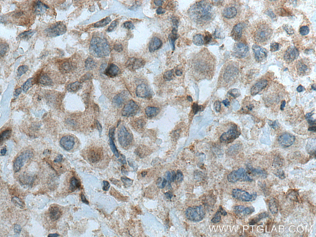 PRKD3 Polyclonal antibody