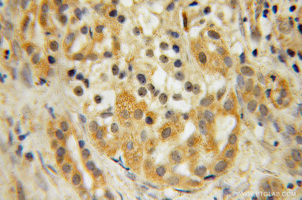 MOBKL1A Polyclonal antibody