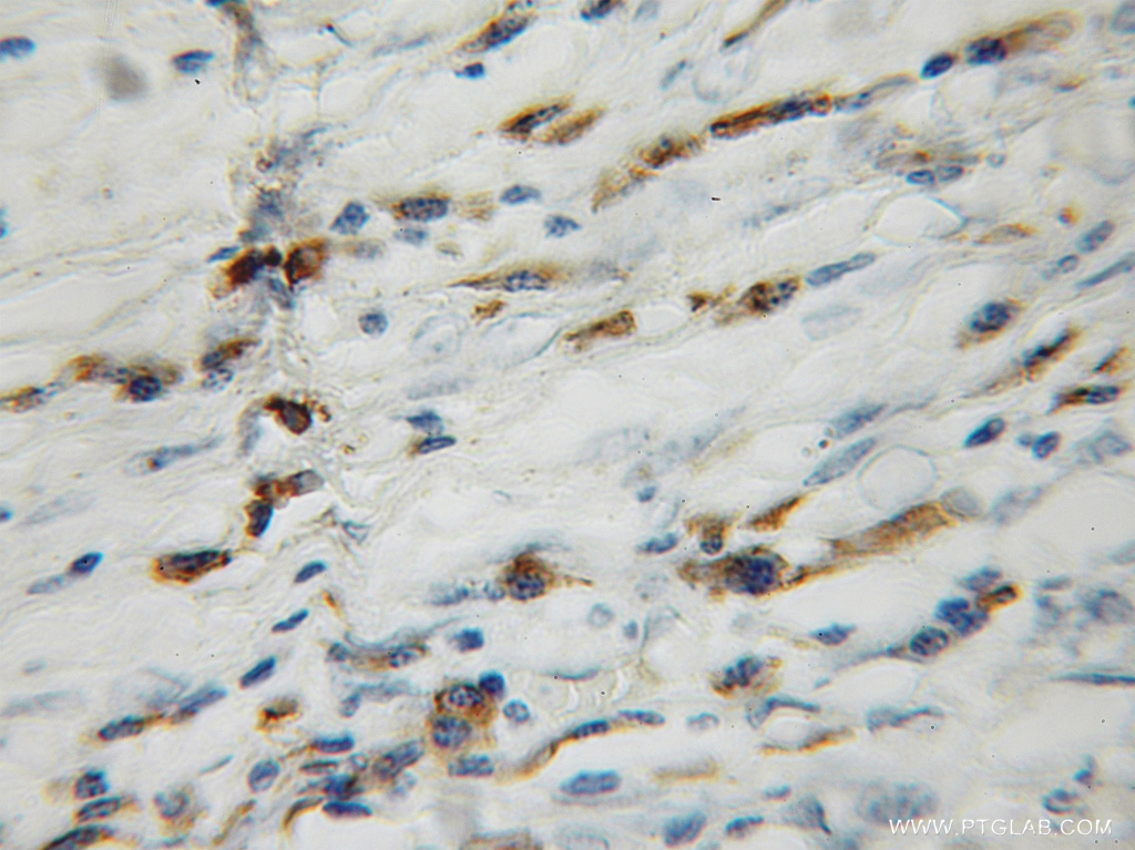 GAGE1 Polyclonal antibody