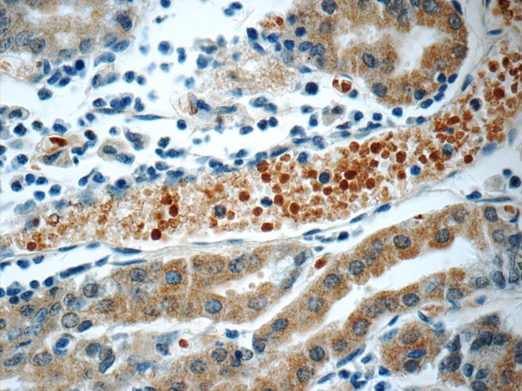 SMAP1 Polyclonal antibody