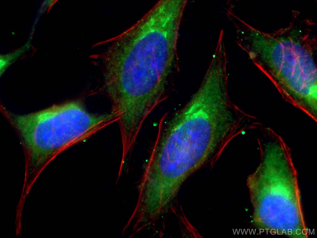 VPS26A Polyclonal antibody