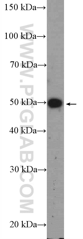 LRAT Polyclonal antibody