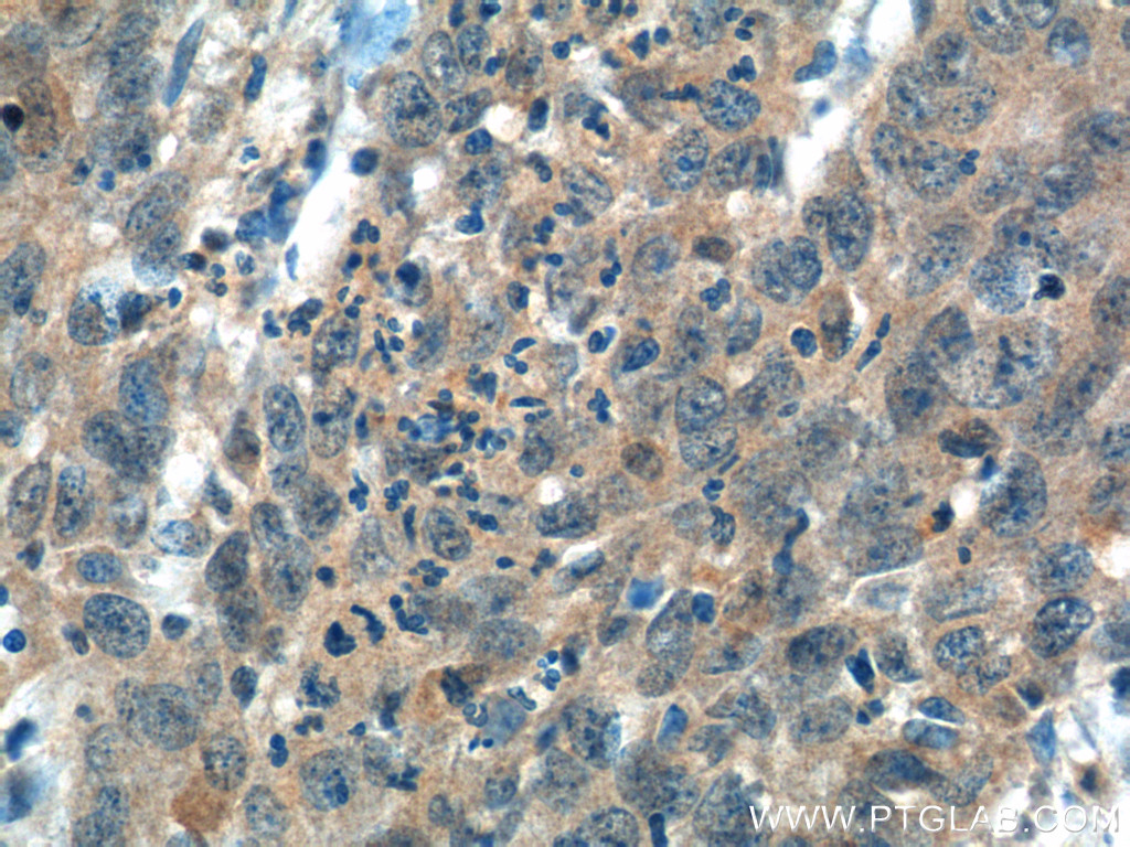 ITPKB Polyclonal antibody