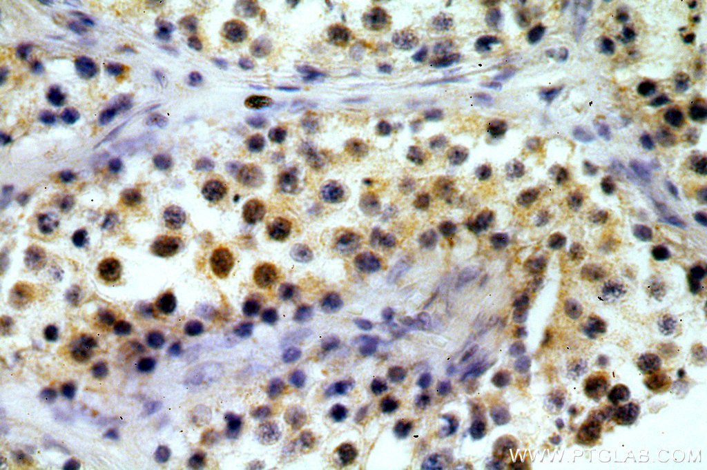 TAF1B Polyclonal antibody