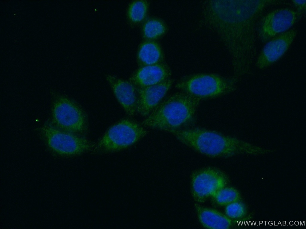 EXTL2 Polyclonal antibody