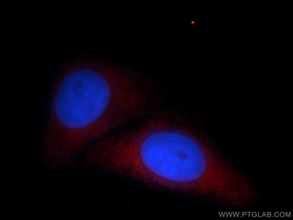 LGTN Polyclonal antibody