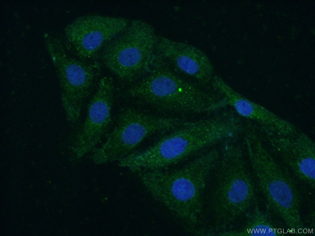 NEK3 Polyclonal antibody