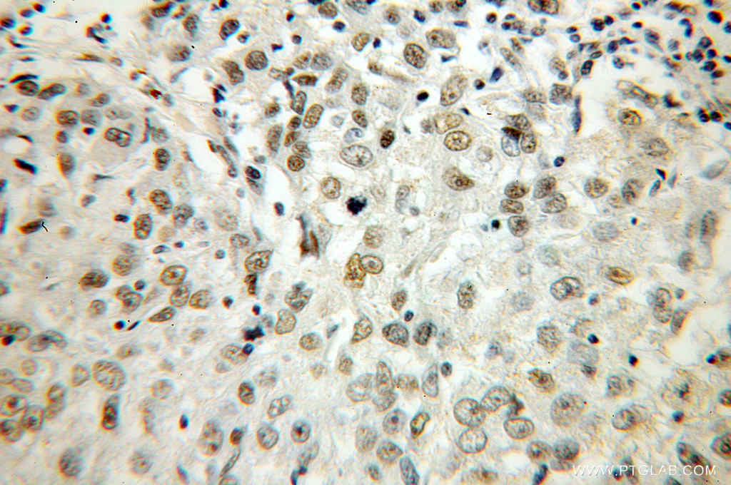 HS1BP3 Polyclonal antibody