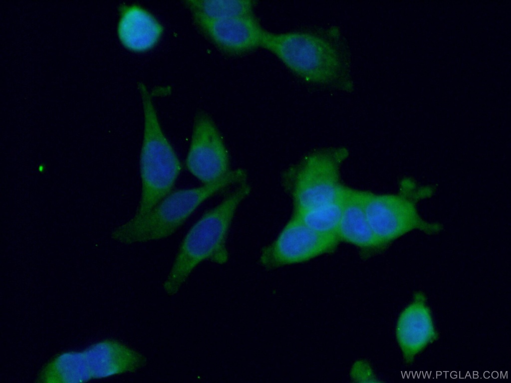BCL2L14 Polyclonal antibody