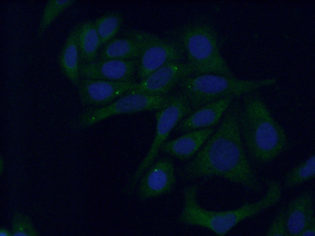 PAMCI Polyclonal antibody