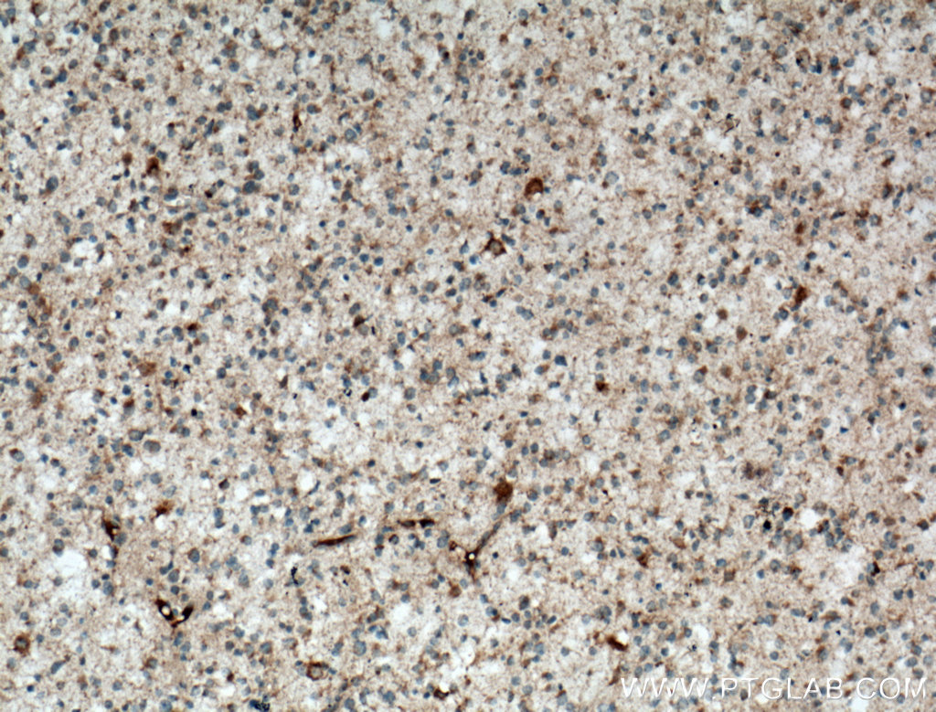 STOML1 Polyclonal antibody