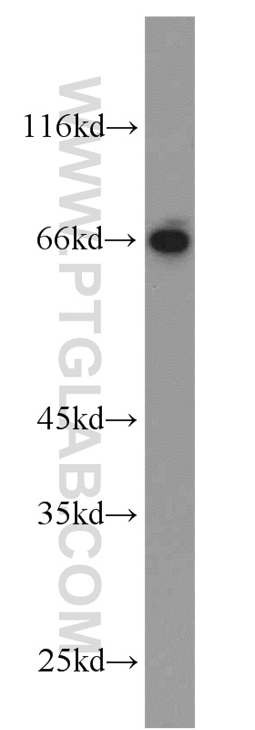 HLF Polyclonal antibody