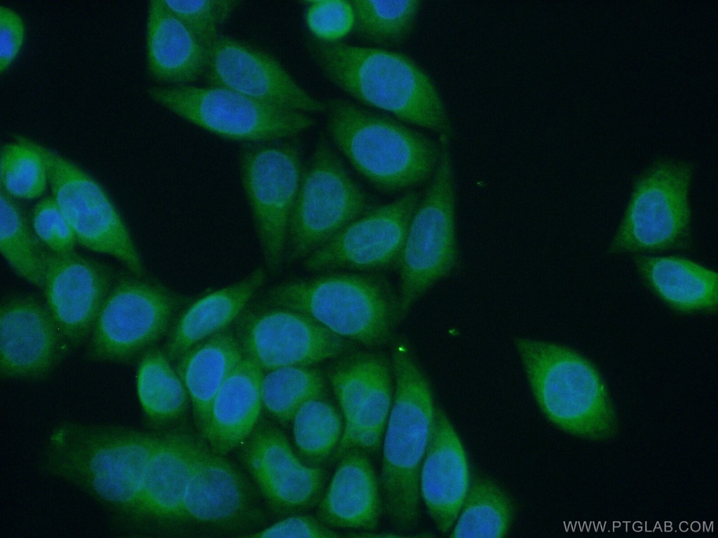 ALG1 Polyclonal antibody