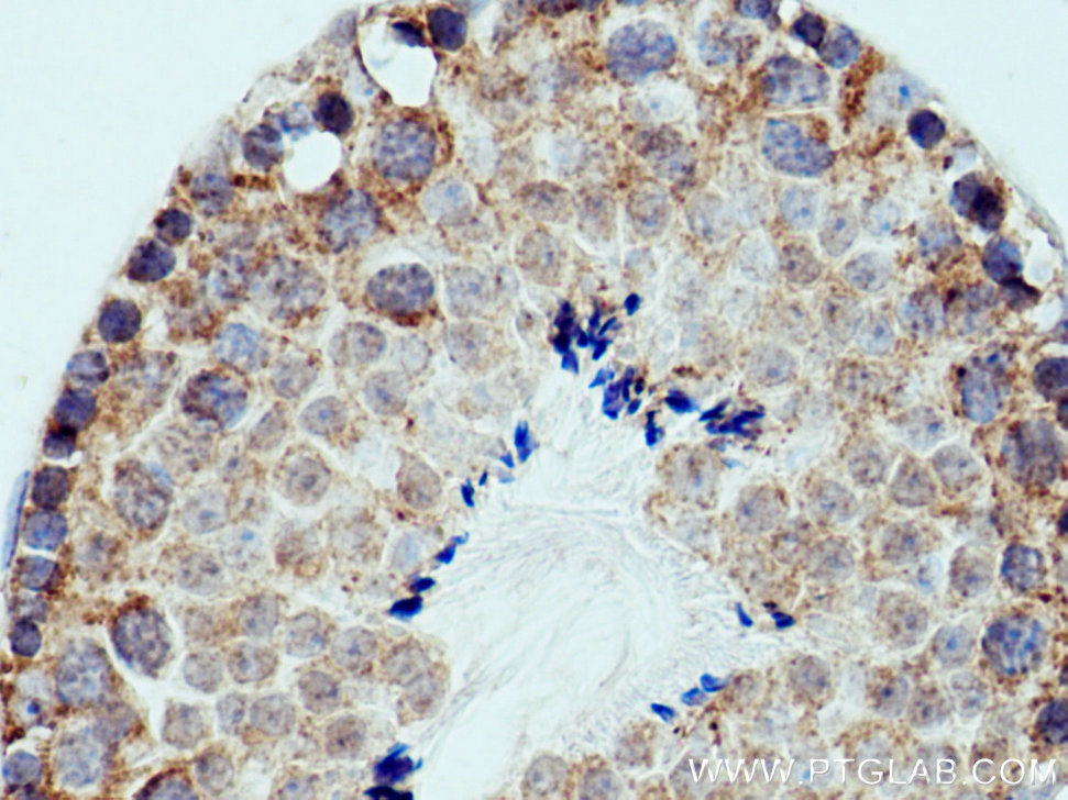 PPEF1 Polyclonal antibody
