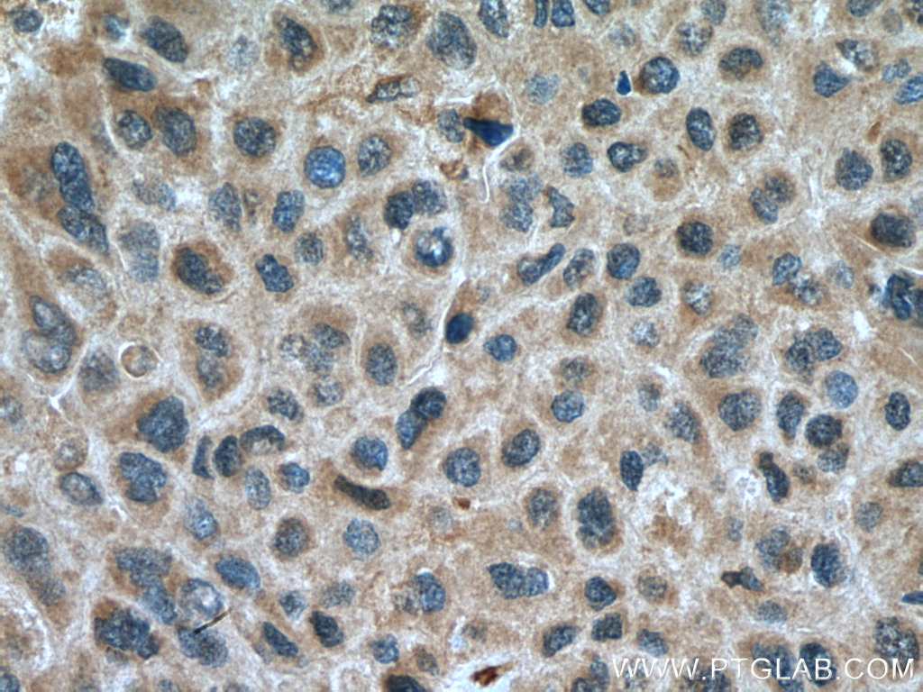 GSDMB Polyclonal antibody