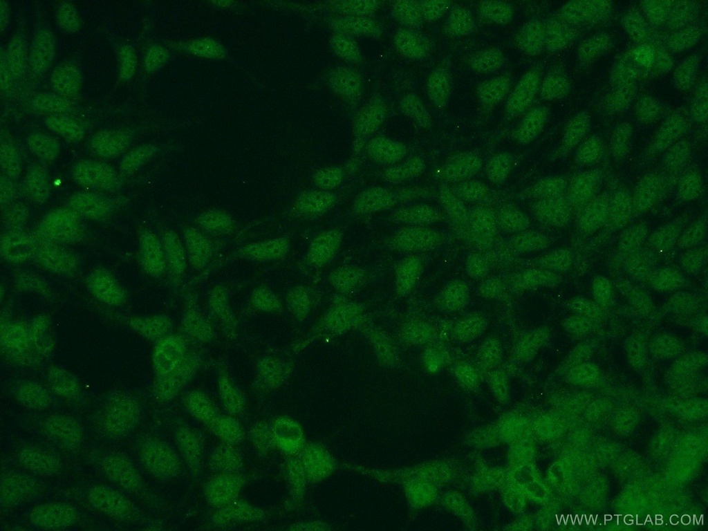 NUDT16 Polyclonal antibody